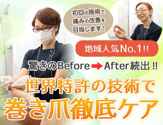 前橋・高崎で巻き爪の根本改善をするなら群馬巻き爪ケアにお任せ下さい