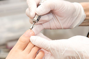 世界特許の巻き爪ケア